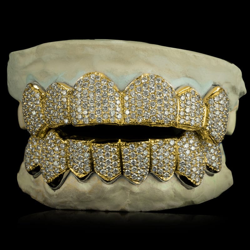 Kenzy Mii- Solid Gold Deep Cut Grillz w/ Bust down options